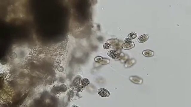 Parasit Zoothamnium sp diinsang ikan Gabus смотреть онлайн