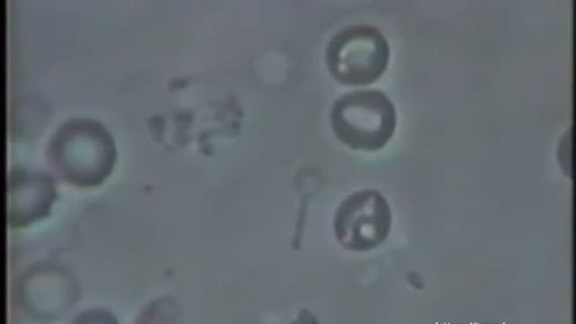 Bacillus anthracis смотреть онлайн