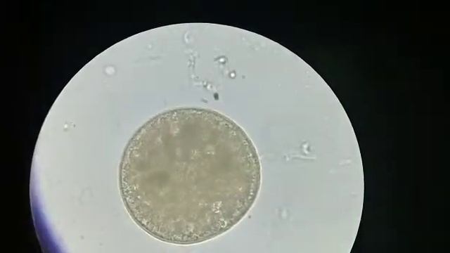 Zoom Parasit Ikan Ichthyophthirius Sp