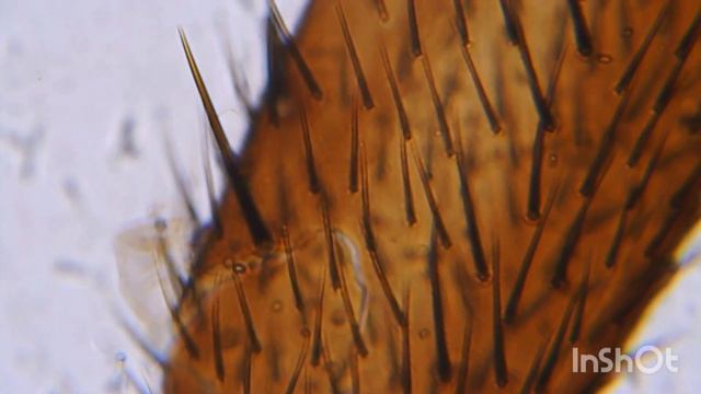 Housefly Leg Under Microscope. Bresser Biolux Nv. Noga Muchy Pod Mikroskopem.