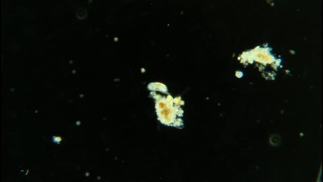 Pond Water Under Microscope