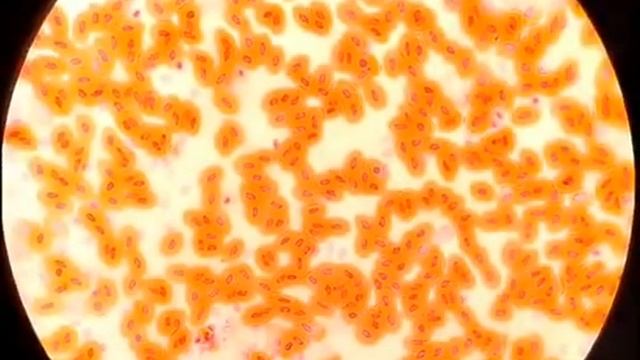 Отличие крови лягушки и человека смотреть онлайн