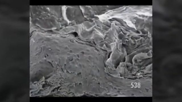 İnsan Derisine Mikroskopla Bakınca, Meydana çıkan Görüntü