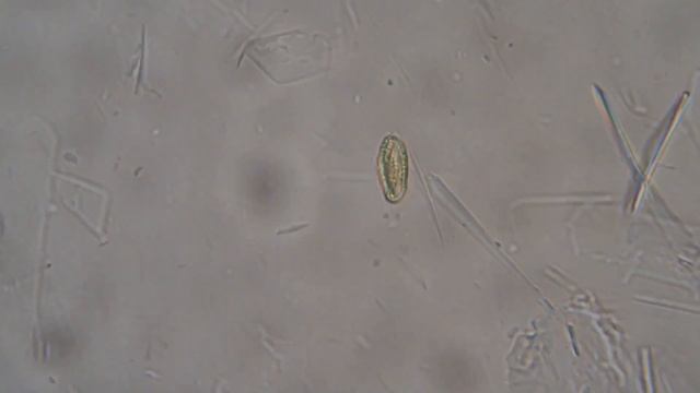 мед под микроскопом.