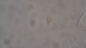 мед под микроскопом.