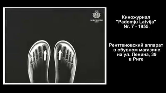 1955 год. Рентгеновский аппарат в обувном магазине Риги на улице Ленина 39 смотреть онлайн
