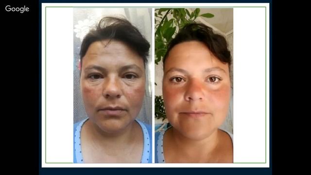 Как улучшить свою жизнь в плане здоровья и финансов! смотреть онлайн