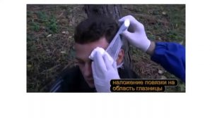 Наложение повязки на область глазницы
