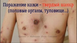 Заболевания, которые передаются половым путем