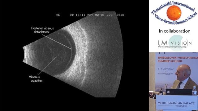 TVRS OPEN DAY 2022-Avitabile. ULTRASONOGRAPHY TODAY.