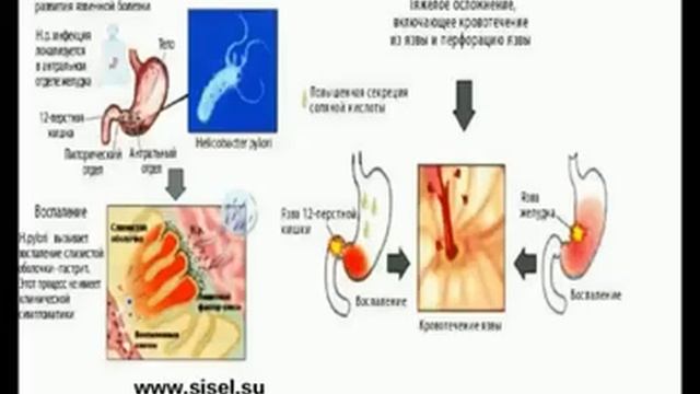 'Заболевания органов пищеварения' смотреть онлайн