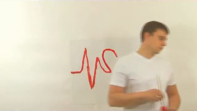 кардиограмма смотреть онлайн