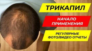 Трикапил - лосьон для роста волос. Начало применения Tricapil / COSMOKEY