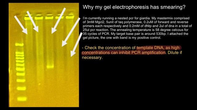 Gel Electrophoresis and PCR troubleshooting смотреть онлайн