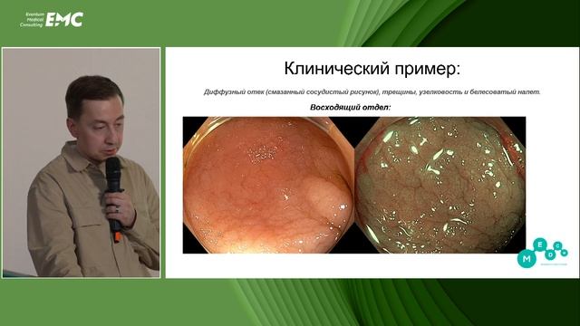 3. Эозинофильные поражения ЖКТ: что нового в этом мире? Валиулин И.Р, Агейкина Н.В, Старченков Д.Д.