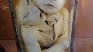 Кунсткамера