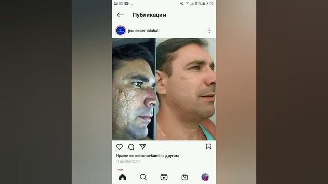 результаты продукции компания JEUNESSE GLOBAL смотреть онлайн