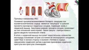 Аритмия, стенокардия, инфаркт миокарда, ишемическая болезнь - причины,симптомы и лечение с Биомедис