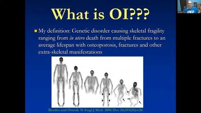 Naviguer à Travers un Nouveau Diagnostique [2022 Conférence Virtuelle de la Fondation pour l’OI] смотреть онлайн