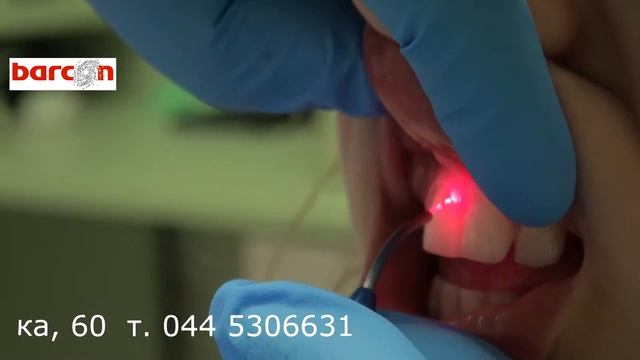 Лазер new смотреть онлайн