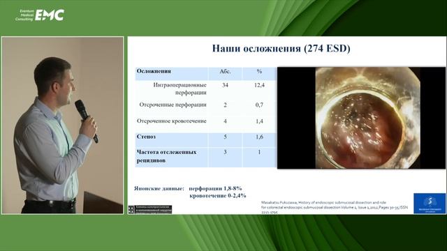 2. Федоренко А.А., Павлов П.В. ESD в толстой кишке. Накопленный опыт побед и поражений.