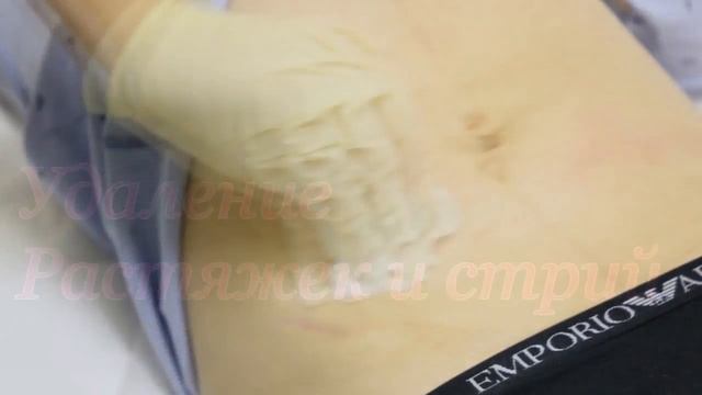 после родов