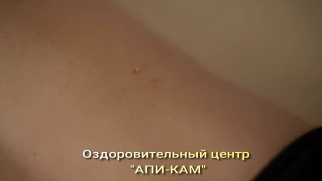 Биопроба на переносимость пчелиного укуса смотреть онлайн