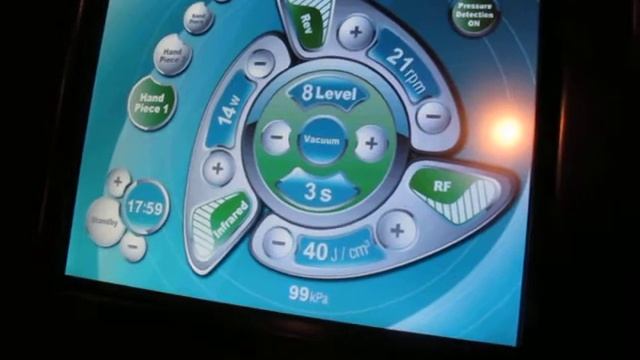 Меню аппарата Inno Shape МИДИС