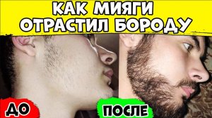 КАК МИЯГИ ОТРАСТИЛ БОРОДУ? Применял миноксидил ДО и ПОСЛЕ