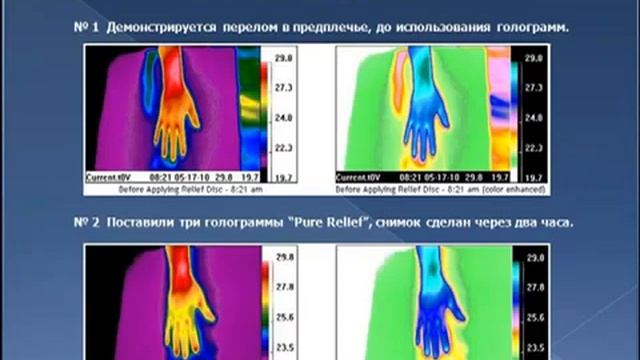 Уникальный тест крови смотреть онлайн
