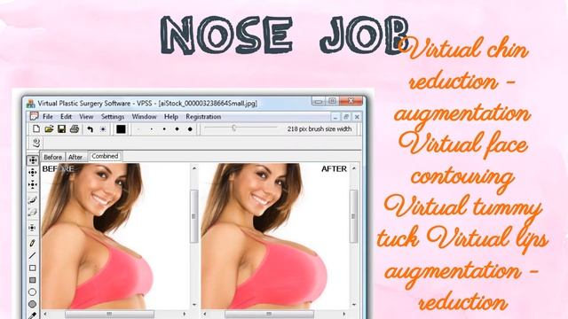 Plastic Surgery Simulator for Windows Review-edit the picture wonderful смотреть онлайн