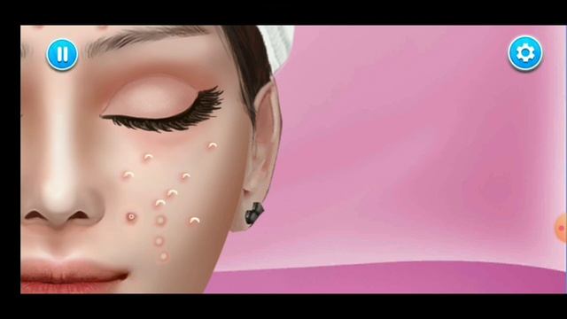 Pimple Remover Asmr Ll Pimple Popper Blackheads Asmr Ll Face Video Ll Pimple Remover Asmr Full Vide