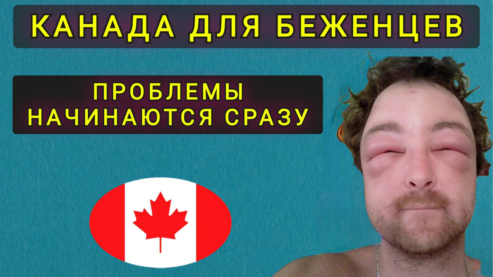 ВЫЖИВАНИЕ В КАНАДЕ. смотреть онлайн