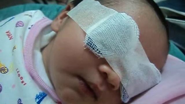 3rd Day Of Andi In Photo Therapy