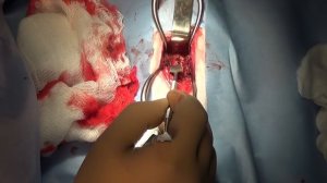 Хирургическое лечение атланто-аксиальной нестабильности у собак