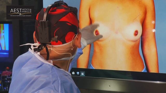 Hybrid Breast Augmentation / Live Surgery / Dr Steve Cohen смотреть онлайн
