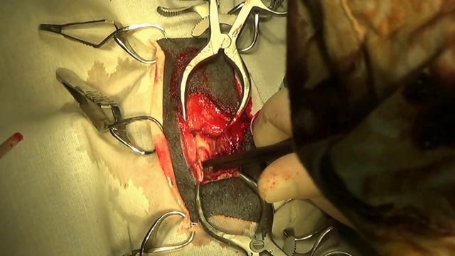 Грыжа межпозвонкового диска у таксы. Intervertebral Disc Disease In Dachshund