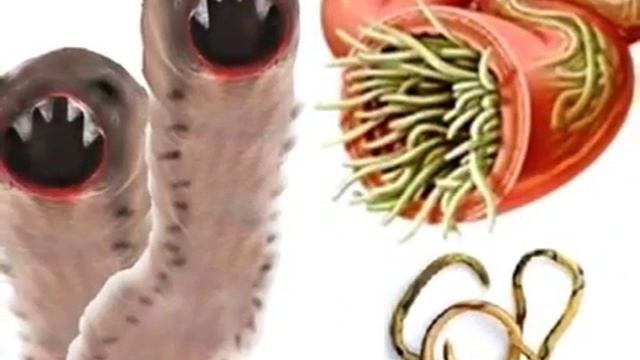 Что разрушает иммунитет и как может помочь флуревитами " ACLON" смотреть онлайн