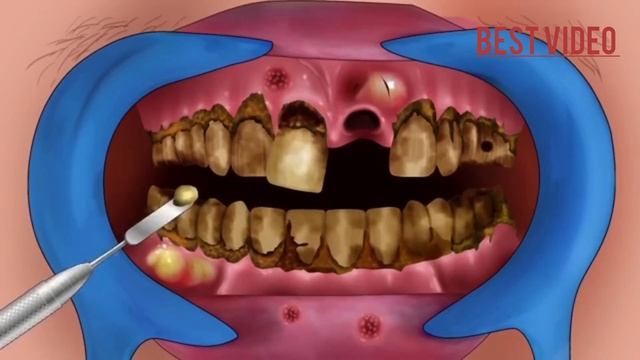 animation/teeth safari ? video смотреть онлайн