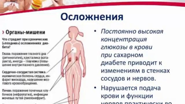 Сахарный диабет и Fitline Лекция врача Галины Костиной