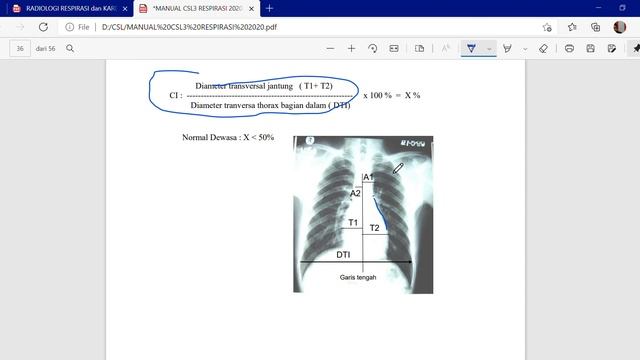 MANUAL CSL3 RESPIRASI 2020 pdf dan 1 halaman lainnya Pribadi Microsoft Edge 2021 06 21 08 30 2 смотреть онлайн