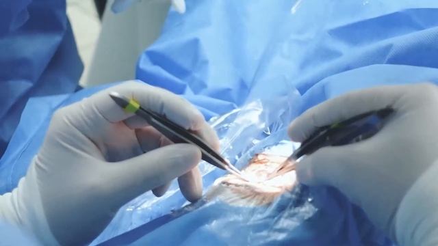 ¿Si tengo un problema en la córnea que debo hacer? смотреть онлайн