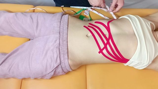 Дренаж живота для похудения, тейпирование