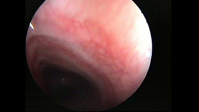 Коллапс трахеи у собаки