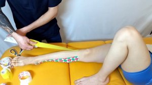 Вальгусное плоскостопие, тейпирование
