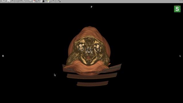 DICOM Viewer Instalación y Funciones Basicas смотреть онлайн