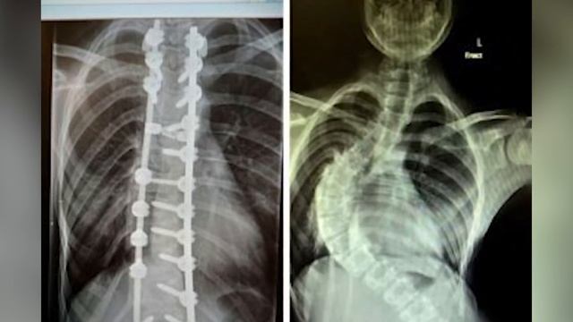 Top 10 Celebrities With Chronic Illnesses - Part 2 смотреть онлайн