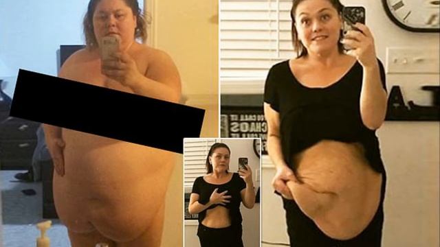 Brave mom shows off her loose skin after losing 150lbs смотреть онлайн