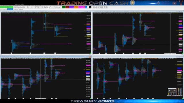 [Emission Bourse et Trading LIVE] "TRADING OPEN CASH" sur BANKABLE RADIO 🔥🔥🔥🔥😀👍👍 смотреть онлайн