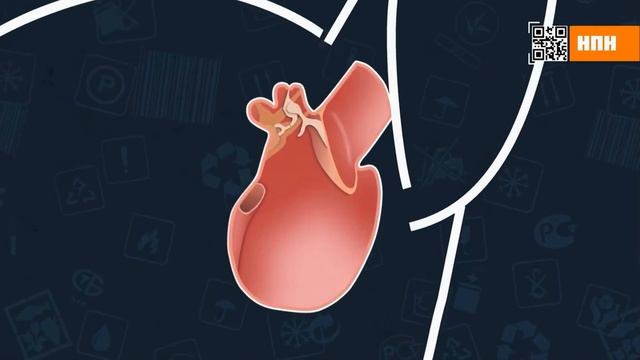 Особенности выбора ультразвукового отпугивателя грызунов. Правда про отпугиватели #крысы #мыши смотреть онлайн